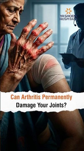 Can Arthritis Permanently Damage Your Joints? | Dr. Jithin Mathew
