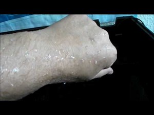 Juwel Innenfilter entfernen