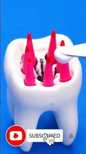 Dental Crown Procedure How a Tooth Is Restored Step by Step #DentalCrown #ToothRestoration