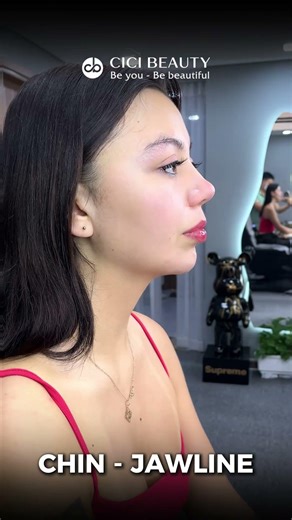 Chin & Jawline Contour at Cici Beauty – Defined Profile in Hanoi\n\nChin and jawline contouring is a p