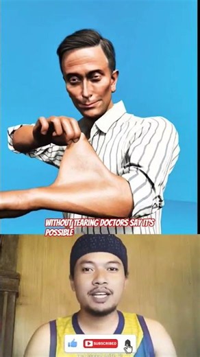 😱 This Man's Skin Stretches Like Rubber... It's Real