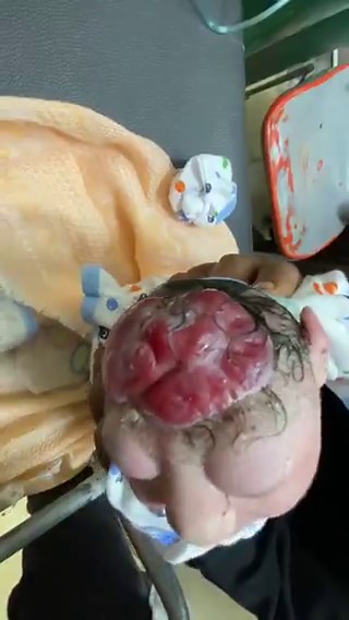 A newborn delivered with a major congenital anomaly.First moments, critical decisions.What would you do first?Diagnosis?