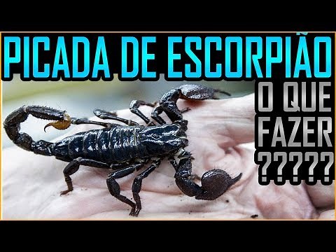 Picada de Escorpião - Aprenda o que Fazer! (Butantan)