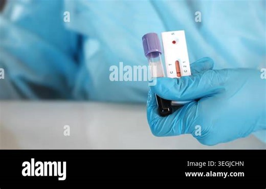 Close up of laboratory worker holding blood sample tube and rapid diagnostic test during medical screening and laboratory analysis Stock Video Footage - Alamy