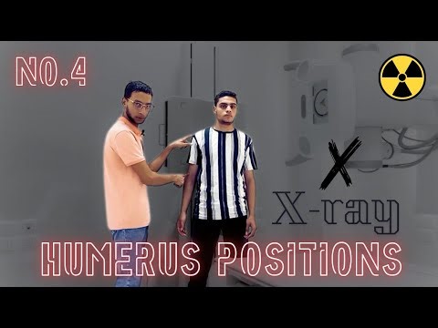 x-ray positions of humerus ( Humerus AP/Humerus lateral)