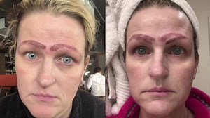 Botched microblading procedure leaves woman with four eyebrows