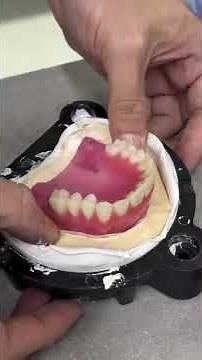 How dentures are made