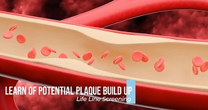 Schedule a screening today! Life Line Screening provides Cardiovascular Health & Stroke Risk Screenings to local communities at over 14,000 screening events across the U.S. each year. Join the 10 million people who have gained peace of mind or early detection of health risks. Schedule today: https://discover.lifelinescreening.com/fb21/?sourcecd=SFBG021 | Life Line Screening