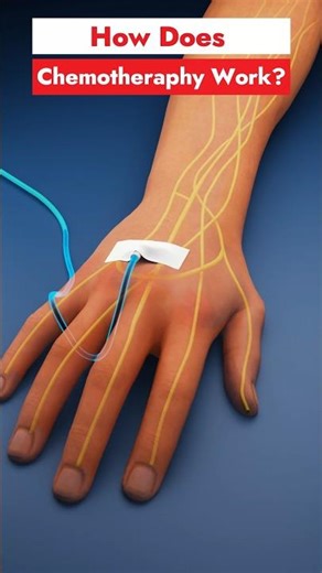 How does chemotherapy work?