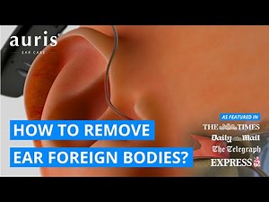 How To Remove Something Stuck In Your Ear? | Ear Foreign Body
