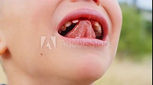 The boy is crying, experiencing a little pain after his front baby tooth was pulled out. Children's fear and tears.