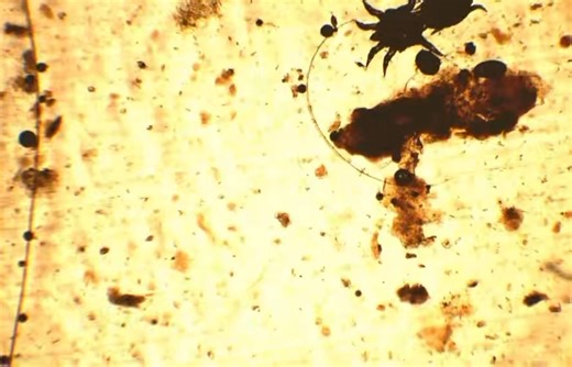 Scan a microscope slide with us! 🔬🧫 This is a microscopic view of a sample from a dog’s ear. Shown on the slide are ear mites 🦠🕷️ Ear mites (Otodectes Cynotis) are tiny parasites that live in the ear canals of animals like cats, dogs, and ferrets. They cause intense itching, head shaking, and a dark, crusty discharge. They spread through close contact with other infected animals and can lead to secondary infections if untreated, though they are treatable with veterinary prescribed medication