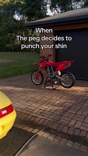 Gotta be worse than a stack😖😣 | metal pegs