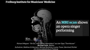 176K views · 1.5K reactions | An MRI scan on Wednesday, produced by the Freiburg Institute for Musicians’ Medicine, shows opera singer Michael Volle performing a song from the German composer’s opera ‘Tannhäuser’ in real-time. The MRI was produced as a part of ENT (Ear Nose Throat) research project and is part of a study to see what happens inside an opera singer’s mouth when they perform | Guardian Science | Facebook