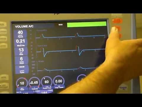 RESPIRATORY CARE: AVEA set up