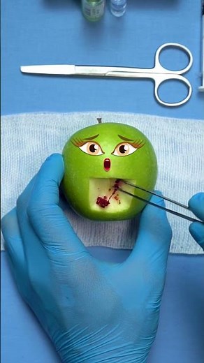 Surgery to turn an apple into a strawberry #doodlevideo #emergencysurgery