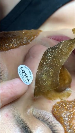 Whitehead + Blackhead Deep Cleaning | Skincare Treatment(instant results)