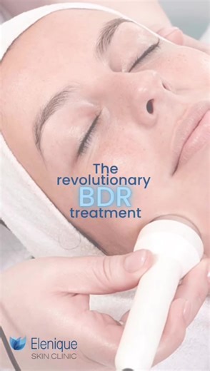 Try our revolutionary BRD treatment! ✨ BDR (Beauty Defect Repair) is a revolutionary facial treatment that restores radiant, youthful complexions. BDR is the cult anti-ageing treatment offering lasting results with a pain-free treatment experience. The benefits of the BDR treatment: ✨Improves pigmentation and uneven skin tone ✨Naturally stimulates collagen and elastin production to visibly firm skin ✨Helps to reduce acne scarring ✨Improves lines and wrinkles Head to the link in our bio to book y