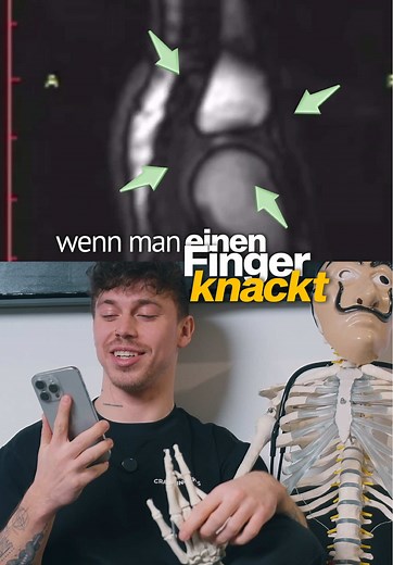 Fingerknacken und Gelenke: Die Wahrheit hinter dem Geräusch