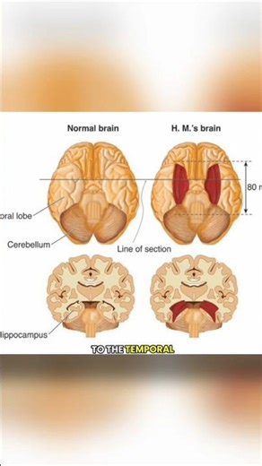 The Man with the Shortest Memory of All Time