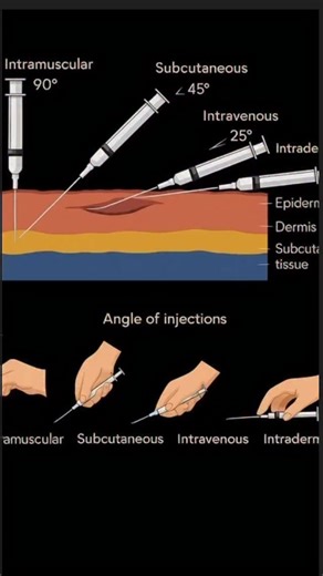Explaining Biology on Instagram: "Not All Shots Are Created Equal - Your Quick Guide to Injection Types Ever wondered why some shots go in your arm muscle and others just under the skin? Here’s the breakdown: Intramuscular (IM) → Deep into the muscle (vaccines, hormones) Subcutaneous (SC) → Into the fatty layer (insulin, blood thinners) Intravenous (IV) → Straight into the vein (instant effect) Intradermal (ID) → Just under the skin surface (TB tests, allergy testing) Intraosseous (IO) → Into bo