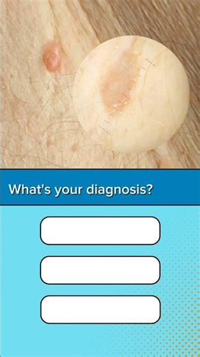 Dermoscopy quiz 1 #medstudent #dermoscopy