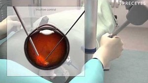 Partnership to test robotic retinal surgery system
