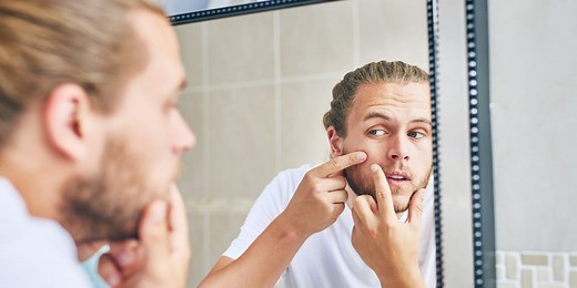 13 Home Remedies for Acne That Actually Work