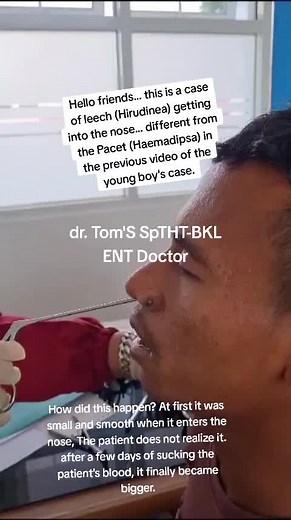 dr Tom'S SpTHT-BKL on TikTok