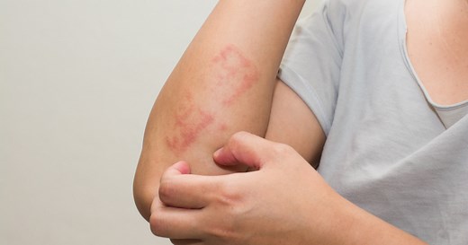 Doenças de pele: estresse e ansiedade podem causar irritações no corpo