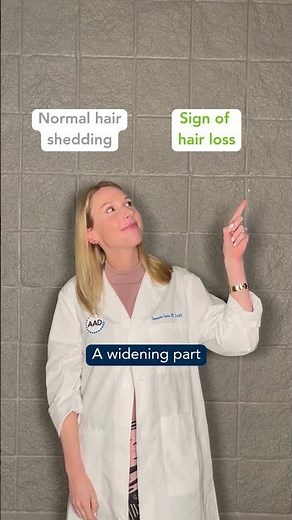 Hair loss vs hair shedding #haircare #dermatologist