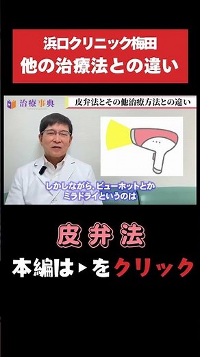 【皮弁法】皮弁法とビューホット・ミラドライとの違い｜ワキガ治療の手術法 #ワキガ #体臭 #皮弁法