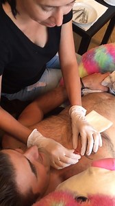 Pimple cyst removal from the chest | iPimplePopping