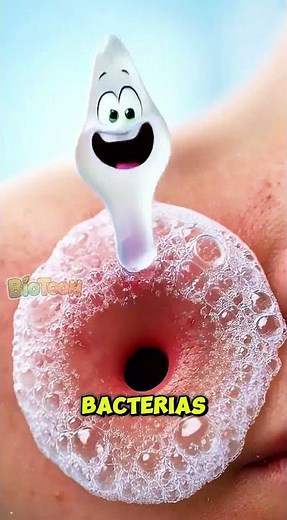 Tipos de Acné y Cómo Tratarlos 🧬✨ | Whiteheads, Blackheads y Cystic Acne