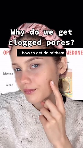 Understanding Clogged Pores: Causes and Treatment