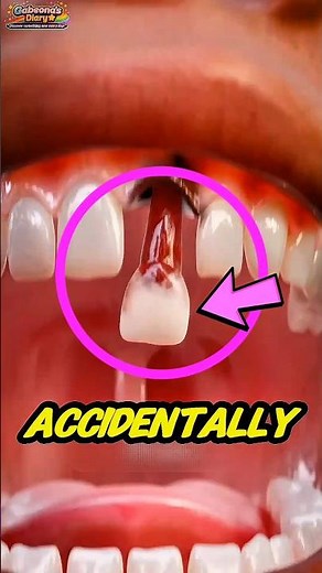 Swallowed a Tooth?! 😳 What Happens Next