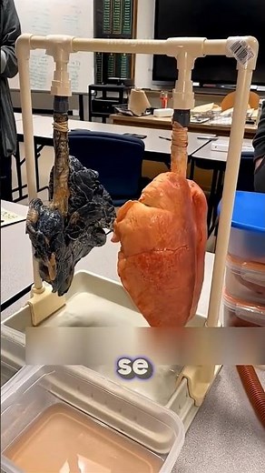 This is why doctors are urging you to stop smoking.