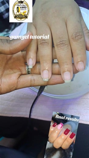 Step-by-Step Guide to Gum Gel Application