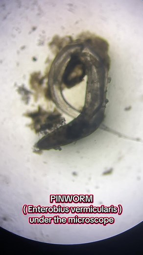 Observing Pinworm (Enterobius vermicularis) Under Microscope