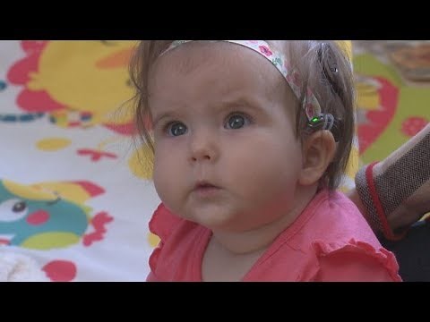 Baby hears for the first time thanks to cochlear implants