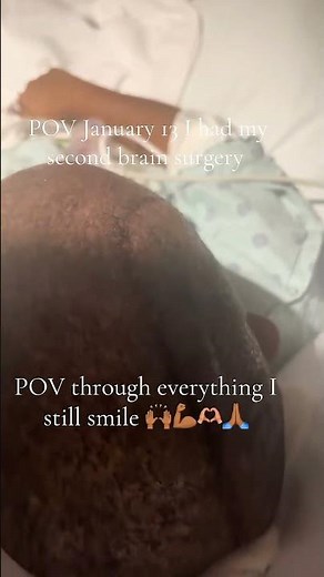 ❤️😍 She emerged from brain surgery victorious and alive.#successfulsurgery #share