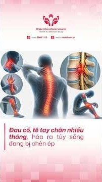 Đau cổ, tê tay chân nhiều tháng, hóa ra tủy sống đang bị chèn ép