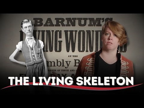 The Astonishing Tale of Isaac Sprague: The Living Skeleton