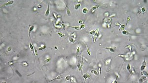 Mikroskop altında canlı insan spermleri (spermatozoa Stok Videosu (%100 Telifsiz) 4431767 | Shutterstock