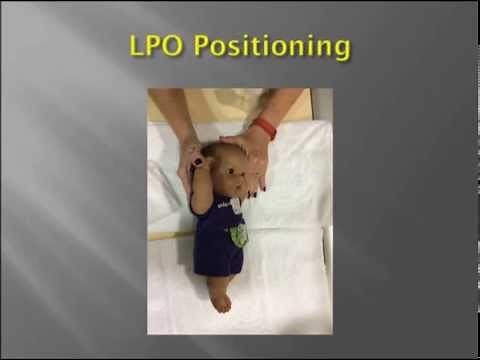 Pediatric Upper GI Fluoroscopy exam