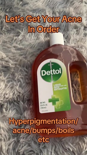 Combat Acne and Hyperpigmentation with Dettol Pink Soap