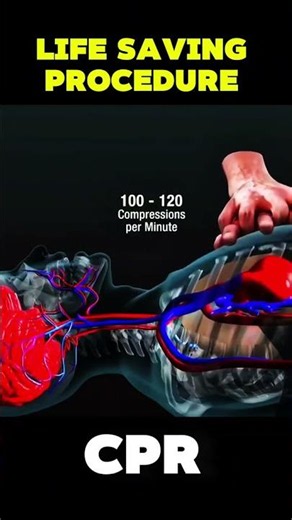 CPR LIFE SAVING PROCEDURE #Cardiopulmonaryresuscitation #CPRheroes