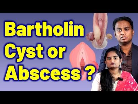 Bartholin Cyst Or Bartholin Abscess Difference | Vaginal Cyst Cure Treatment Cure Medicine Surgery