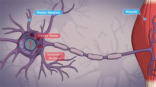 Medical Animation on Instagram: "Explore the intricate world of gene therapy with this in-depth video created by Intervoke (@intervoke) for Cure SMA (@curesmaorg) that explains how genes, specifically the SMN1 gene in cases like Spinal Muscular Atrophy (SMA), can be replaced or corrected using innovative medical techniques. This engaging resource breaks down Gene Replacement Therapy, highlighting how a functional gene is delivered directly into human cells using an adeno-associated virus (AAV)—a