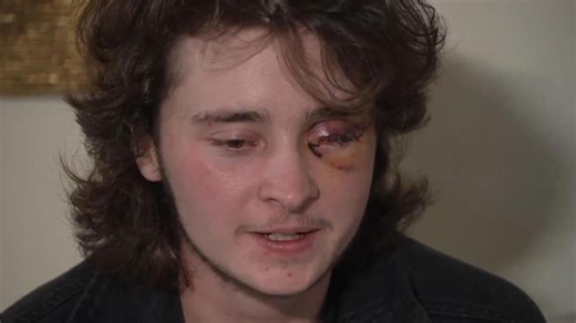 ICE protester injured by nonlethal projectile speaks out